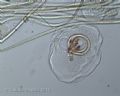Thecamoeba sp.